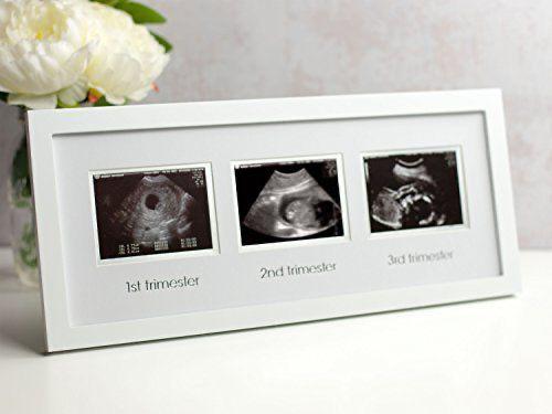 White frame holding first, second and third trimester ultrasound scans